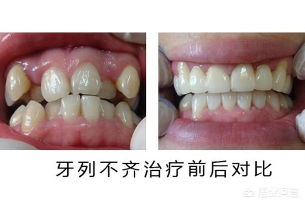 那曲最新24小时牙医在线咨询方法分析(最方便真实的那曲有没有24小时牙医方法)